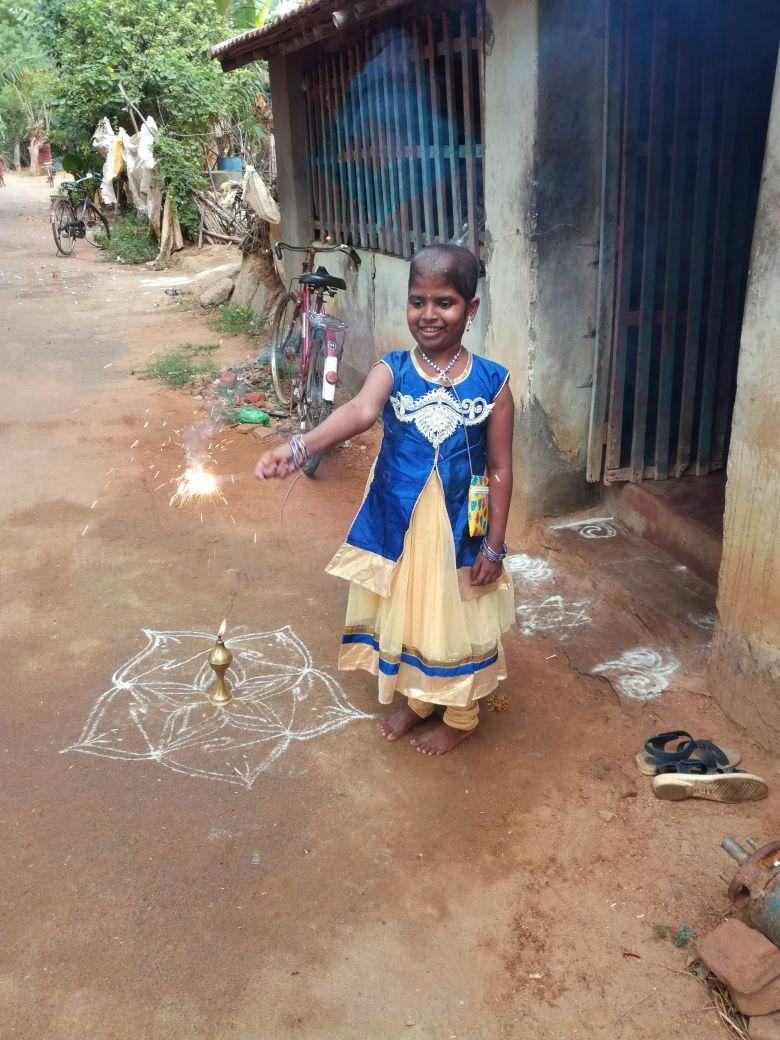 A young girl in festive clothes celebrating Diwali after a successful bone marrow transplant